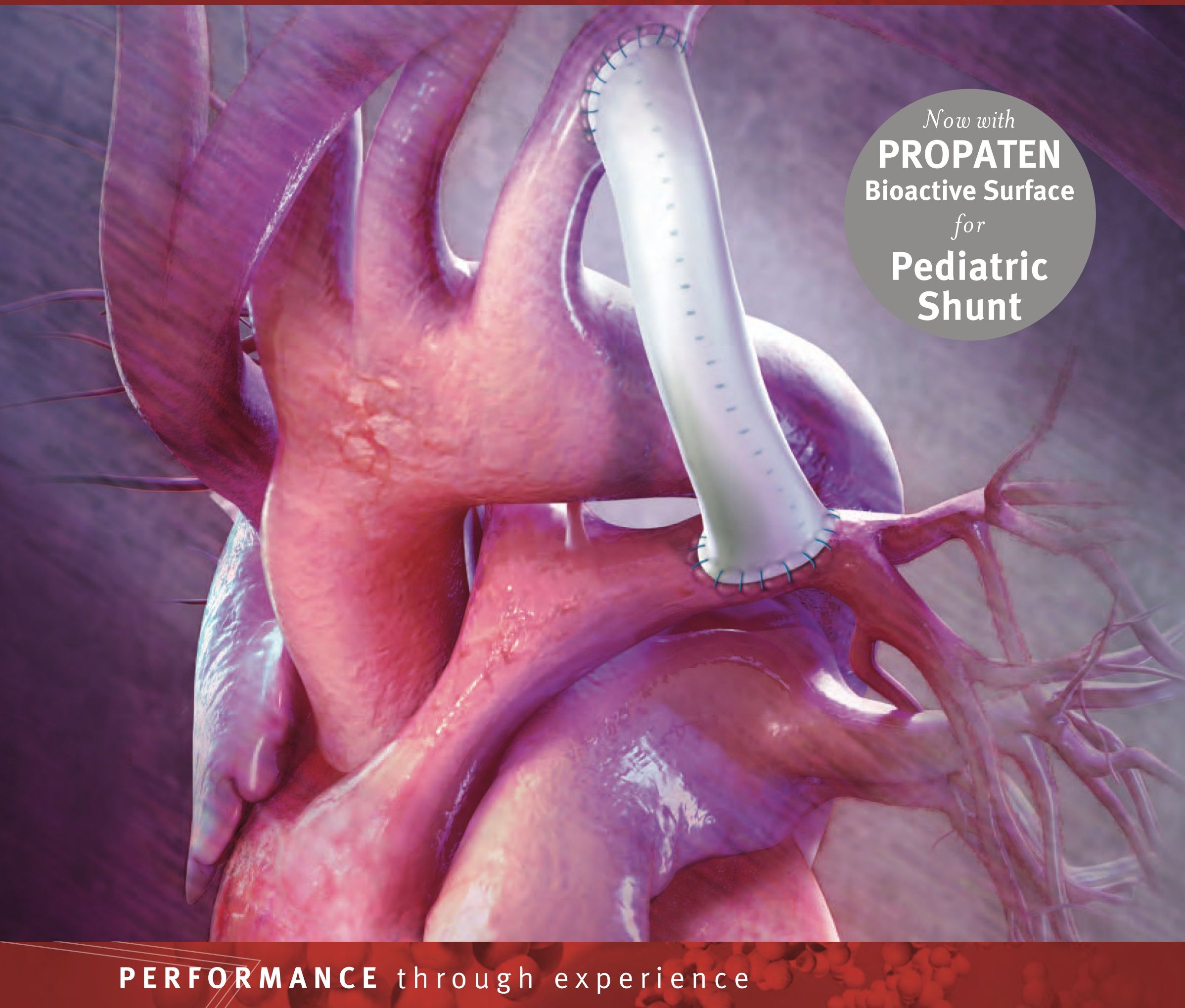 W. L. Gore & Associates — GORE-TEX, PROPATEN & VIABAHN — ePTFE vascular grafts, pediatric shunts, sutures & endoprostheses