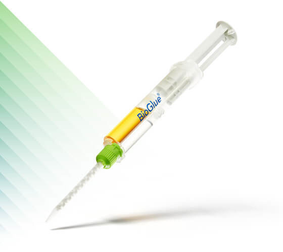 Artivion — Cardiac surgery — sealants & mechanical valves
