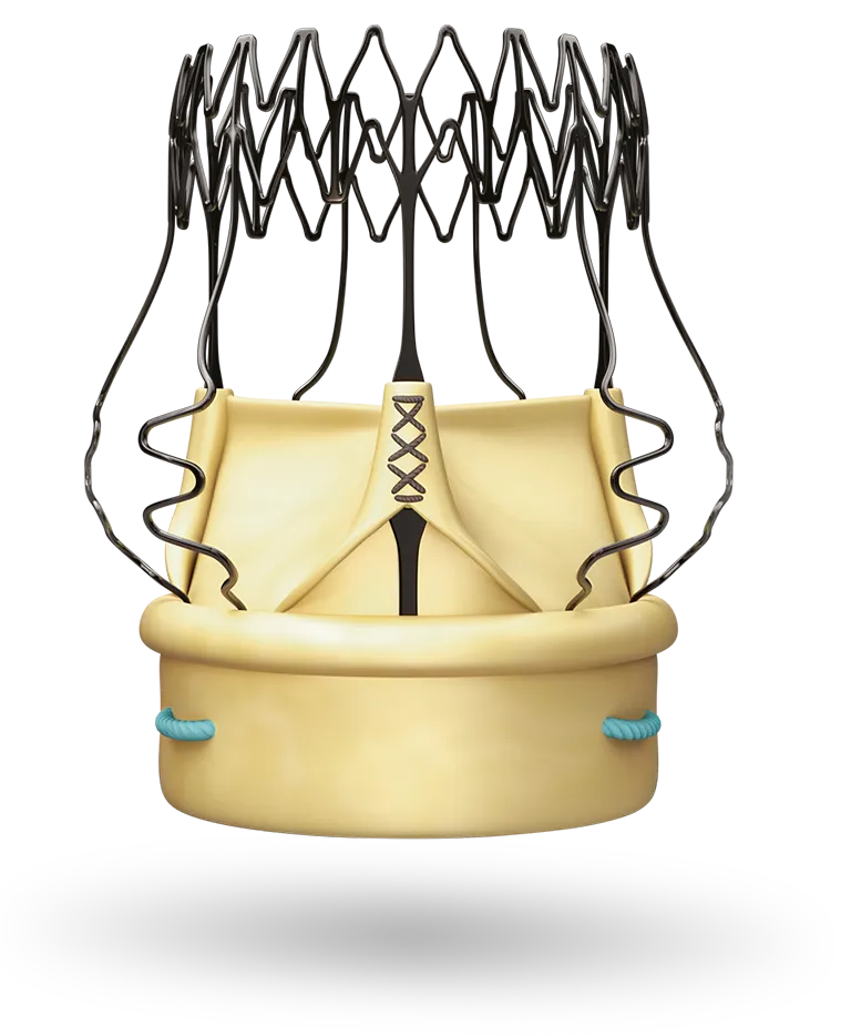 Perceval sutureless aortic valve prosthesis