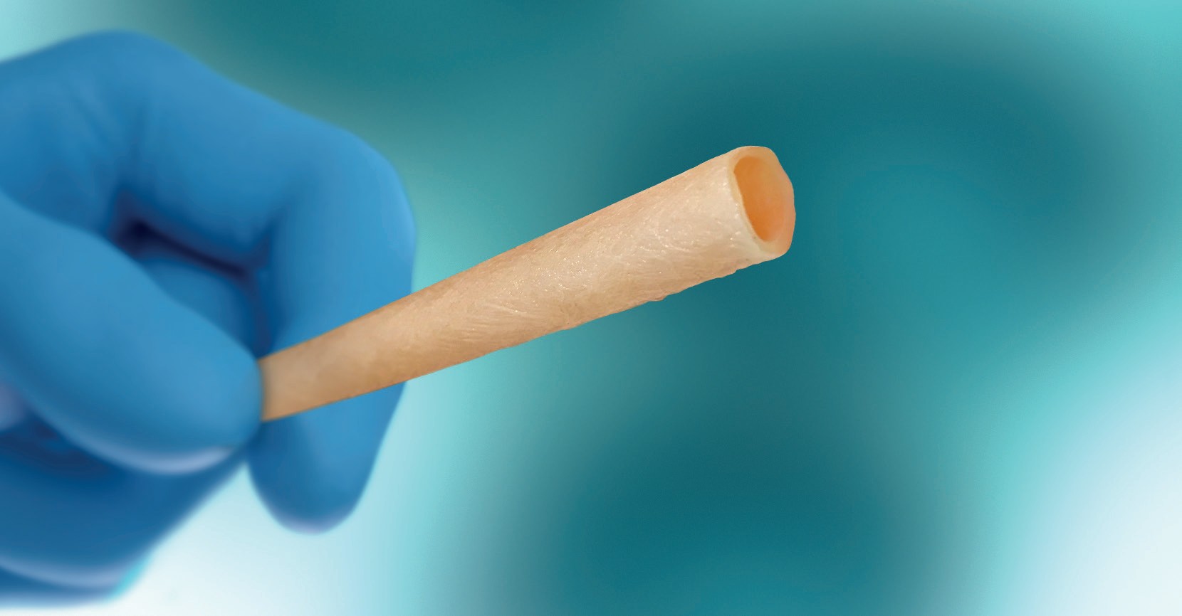Artegraft® Collagen Vascular Graft — bovine carotid conduit for AV access & bypass